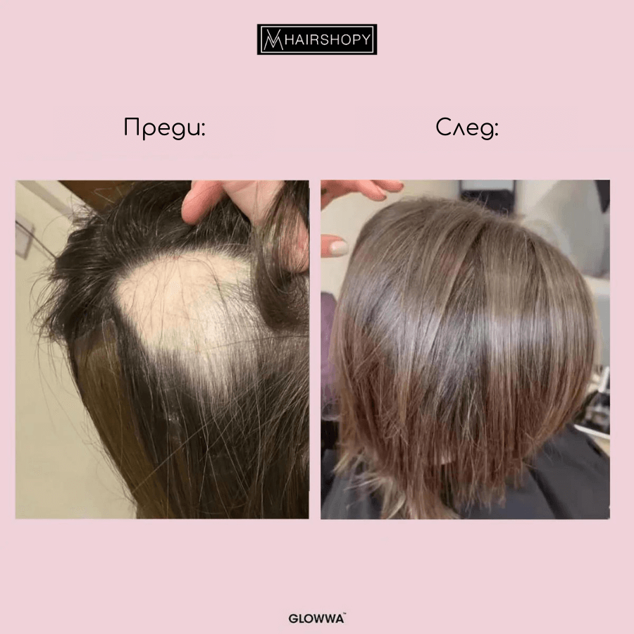 HAIR FOOD™️ | GLOWWA витамини за коса
